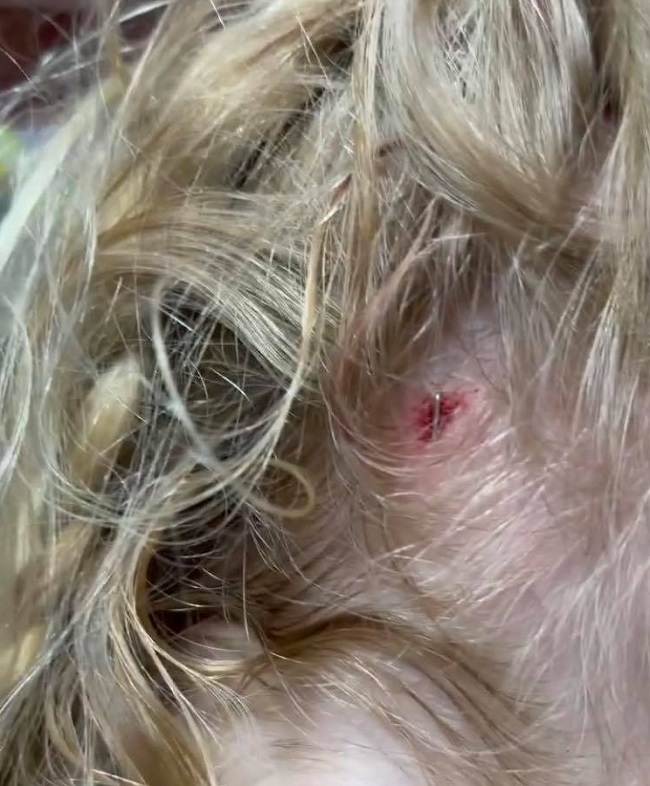 Riley's Head Injury Adam Busby Instagram