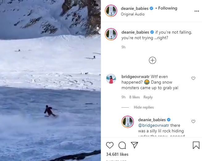Dean Unglert Hits A Buried Rock, Falls While Skiing