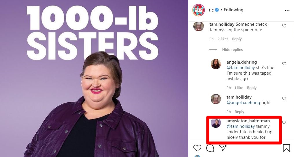 1000-LB Sisters Amy Dishes On Tammy Spider Bite